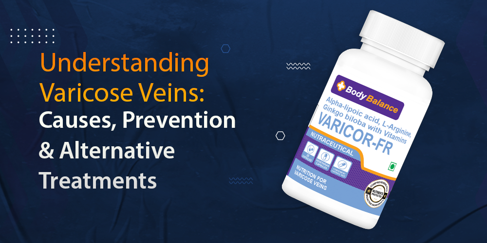 What are Varicose Veins?
