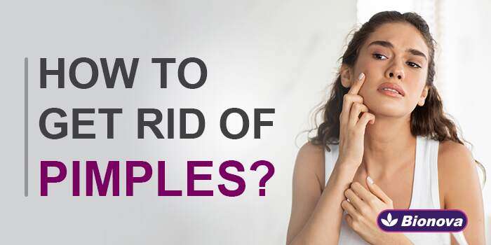 Ways to Get Rid of Pimples