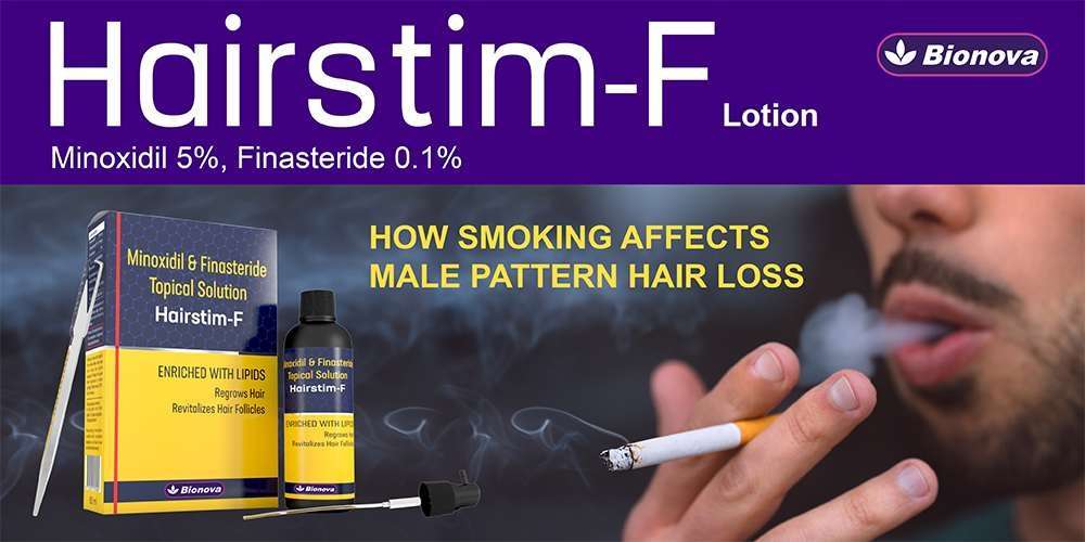 Hair Loss and smoking