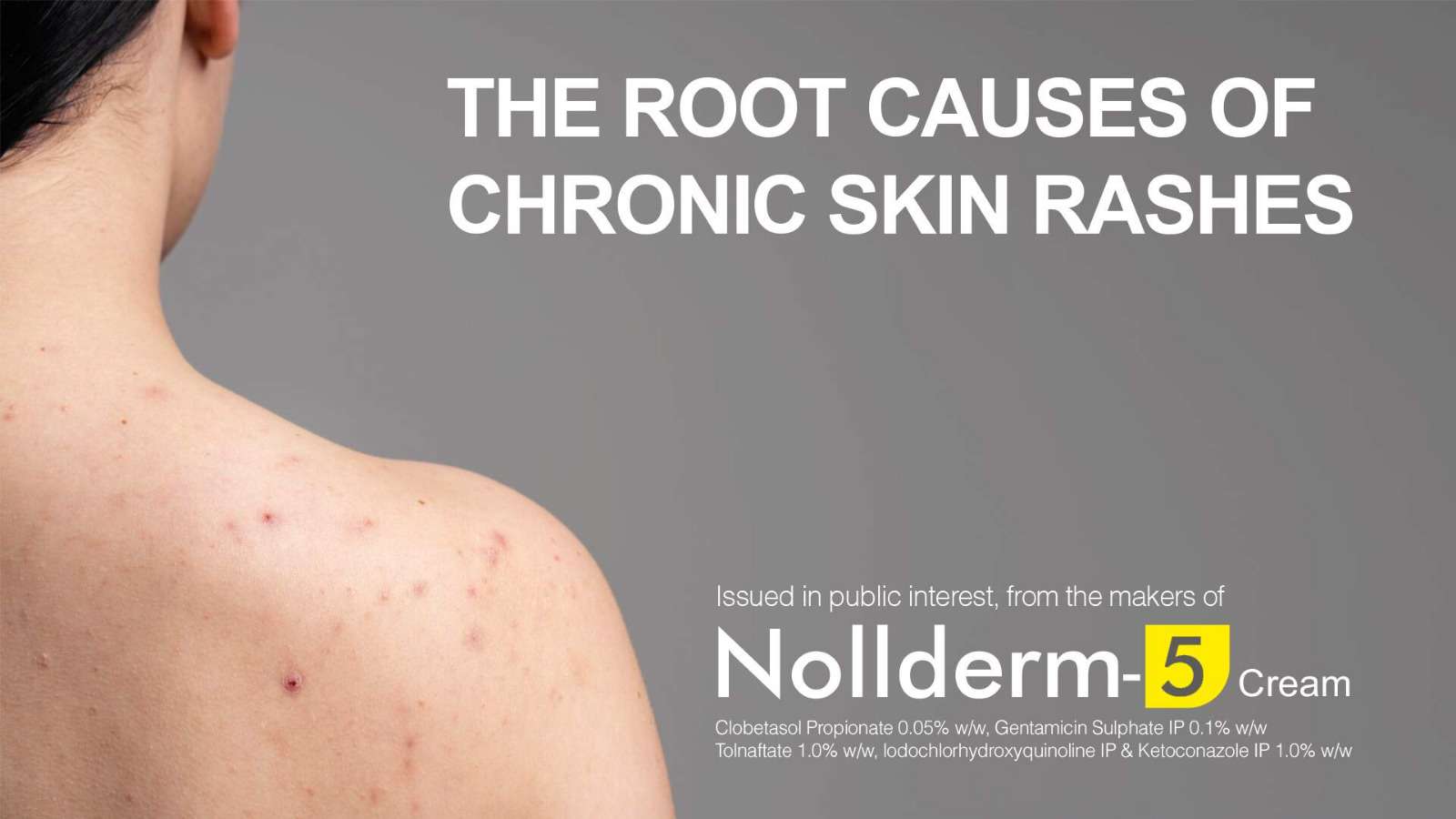 Skin rashes can be red, inflamed, bumpy as well as dry, itchy or painful.